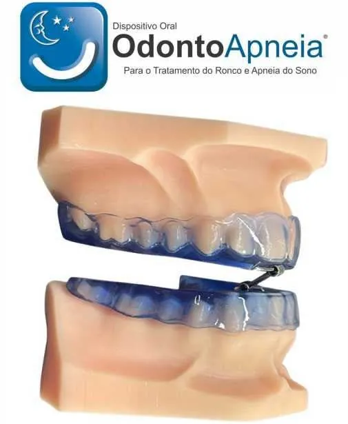 Aparelho para Apneia do Sono do Sistema Odontoapneia, com as duas placas encaixadas no modelo